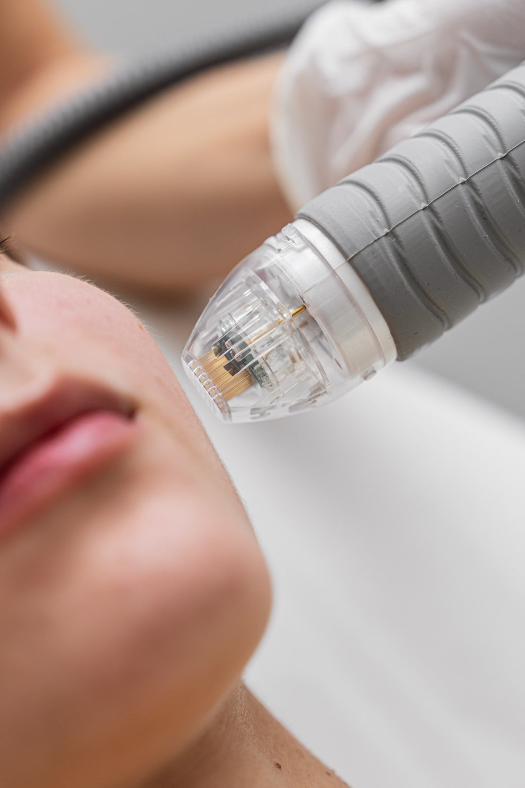 Formation Microneedling 2 jours
