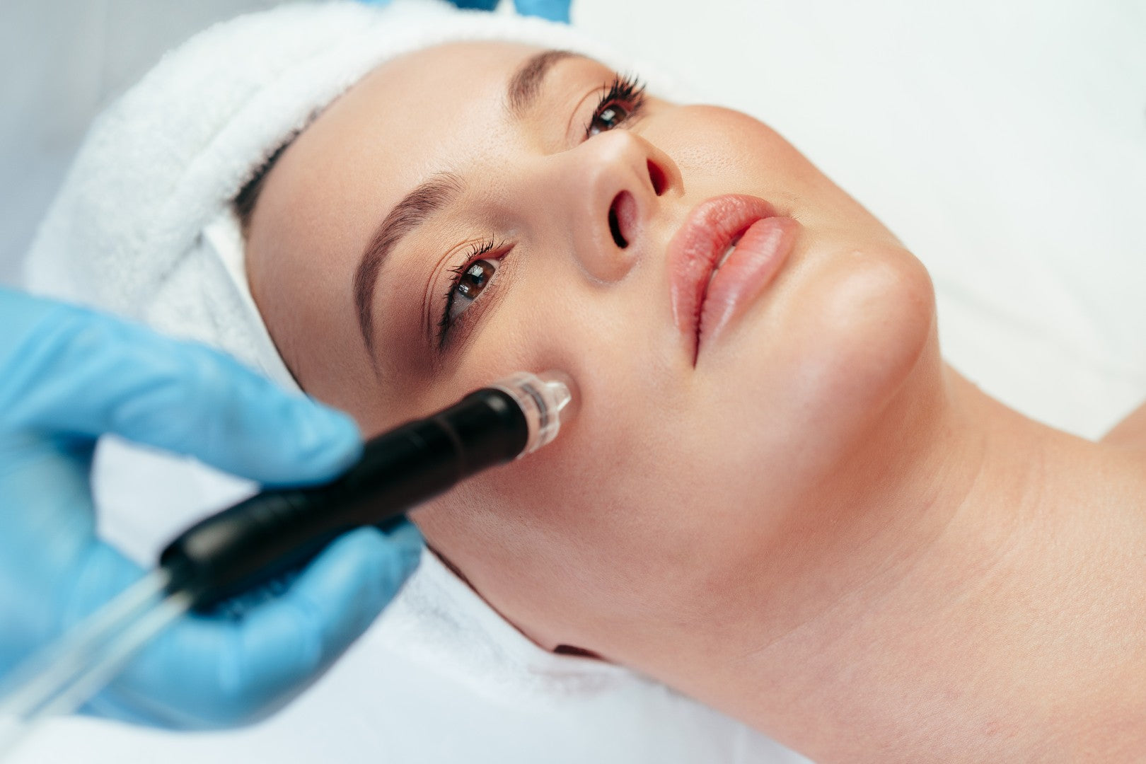 Formation Microneedling 2 jours
